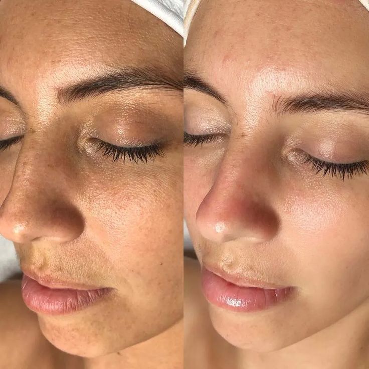 Colágeno Glow Sellium©