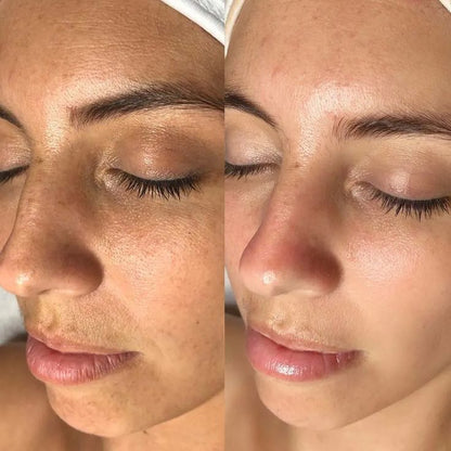 Colágeno Glow Sellium©