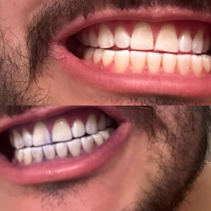 Sellium© Blanqueador